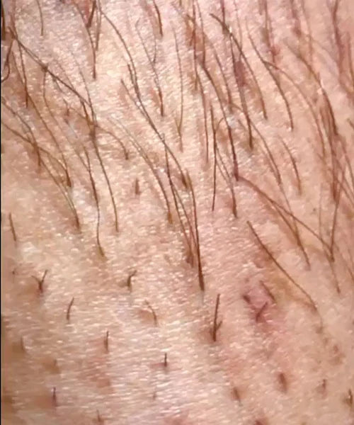 After Image