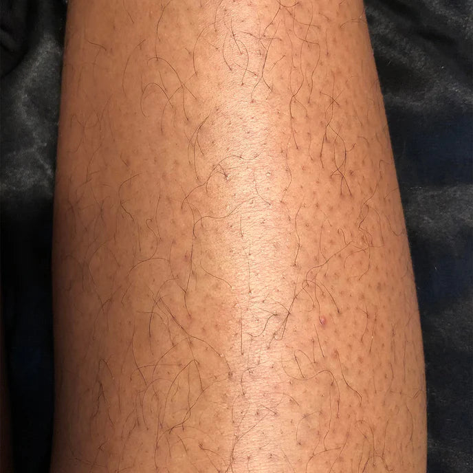 Before Image