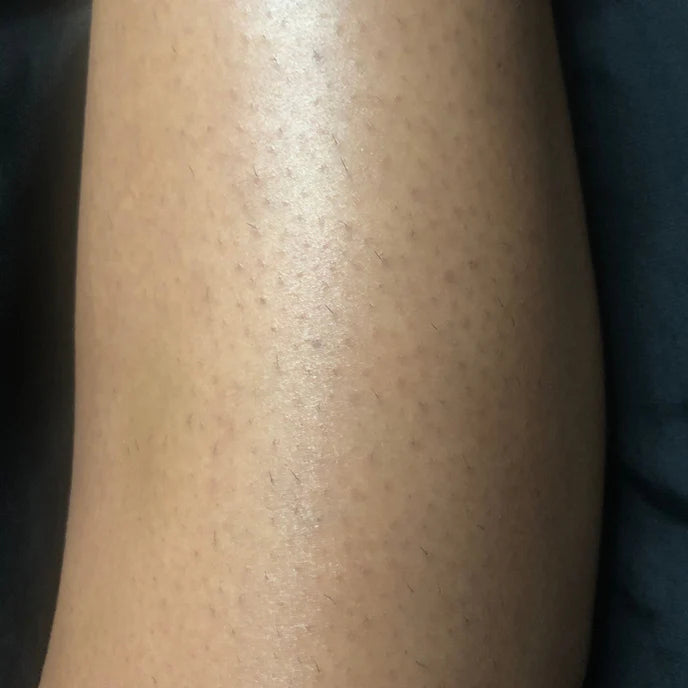 After Image